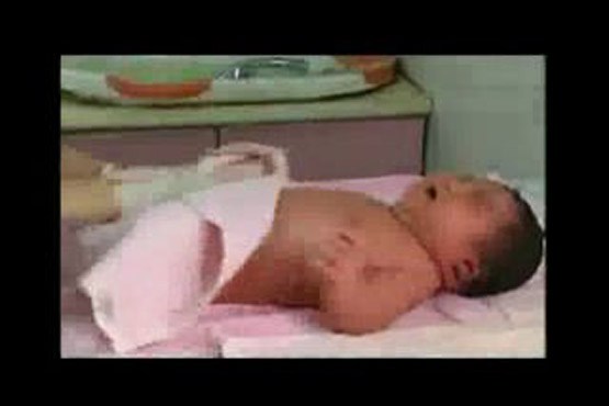چاق ترین نوزاد جهان در چین