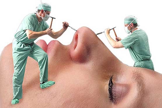 توصیه‌های یک جراح برای عمل بینی