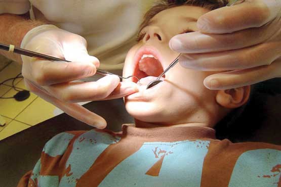 دندانپزشکی,کودکان,دولت
