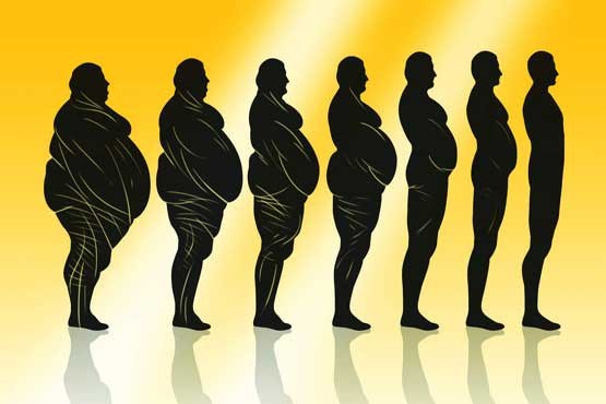 جراحی کاهش وزن مانع از سکته افراد چاق می شود