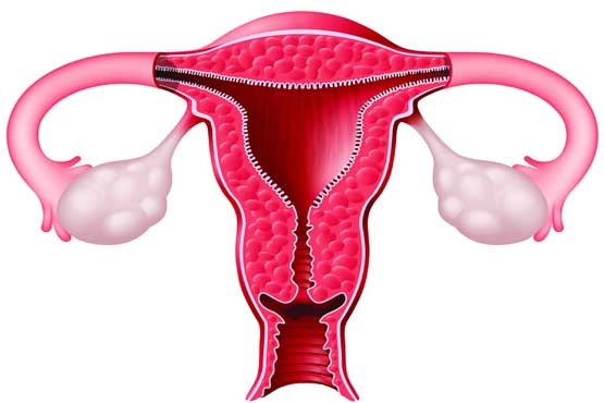 سرطان تخمدان در زنان رو به افزایش است
