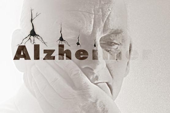 خطر ابتلا به آلزایمر در زنان بیشتر از مردان است