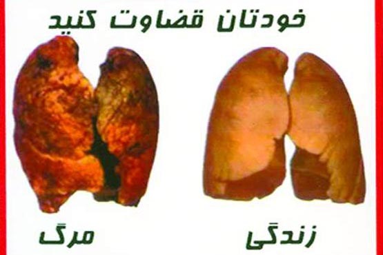 تاثیر اندک هشدار منفی روی پاکت سیگار بر افراد