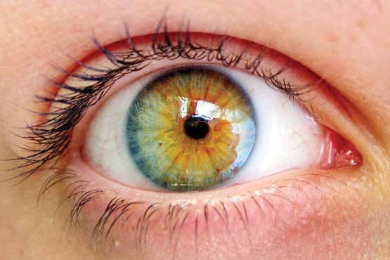 دیابتی ها، بیشتر مراقب چشم شان باشند