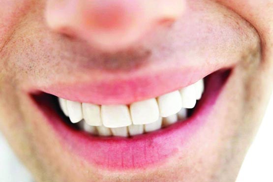 تصویر نوشابه های بدون قند موجب پوسیدگی دندان می شوند