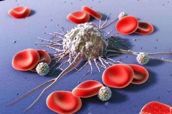 درمان سرطان خون با سلول های طراح