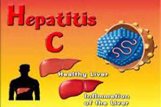 نشانه‌های ابتلا به هپاتیت C