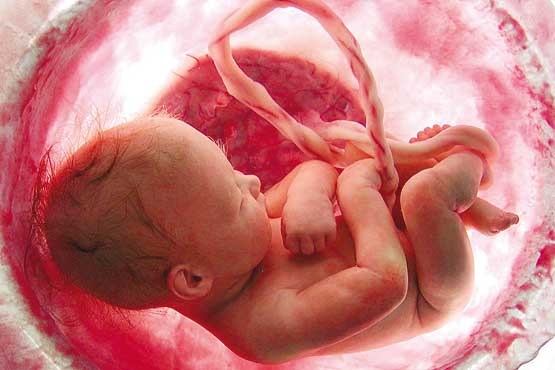 سقط جنین مرگ یک آرزو