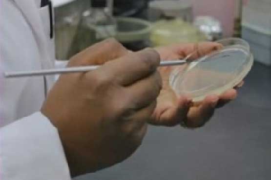 تبدیل سلول های پوستی به کبدی توسط دانشمند ایرانی