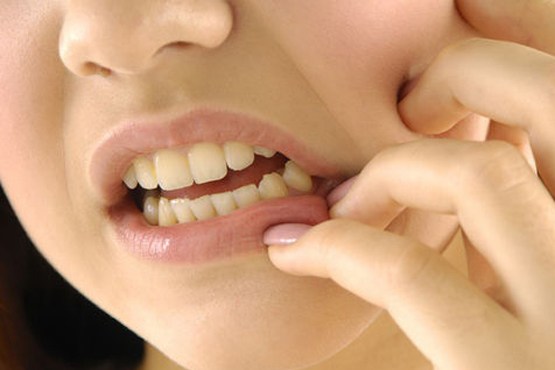 بهترین ضددردهای خانگی برای تسکین دندان درد