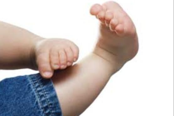 شیوع بیماری پاچنبری در نوزادان