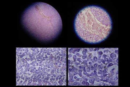 توقف رشد سلول‌های سرطان ریه با نانوبابونه