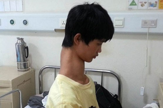 پسری با گردنی عجیب + عکس