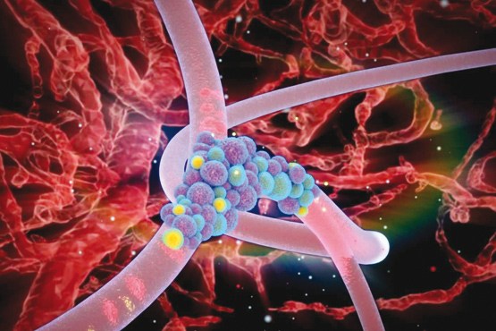 احتمال درمان عفونت درون سلولی با نانونیوزوم‌ها