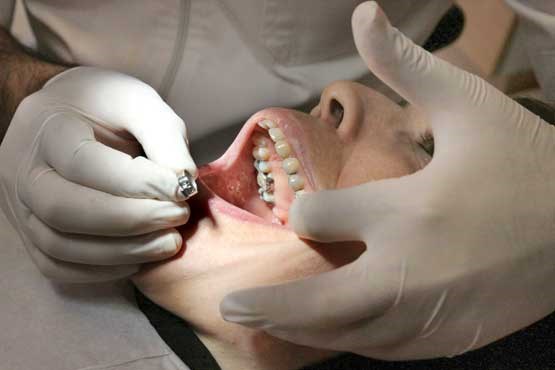 بی‌عدالتی در نظام توزیع دندانپزشکان