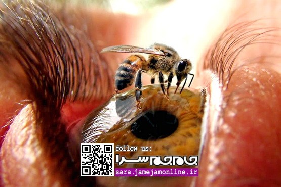 خطرات جدی: اثرات مخرب عسل بر چشم