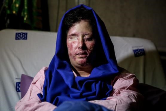 تازه‌ترین خبر‌ها از پرونده اسید پاشی اصفهان