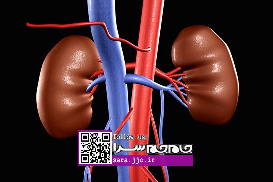 آنچه خطر ایجاد سنگ کلیه را افزایش می‌دهد