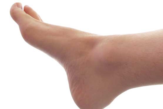 بیماری هایی که از وضعیت پاها تشخیص داده می شوند