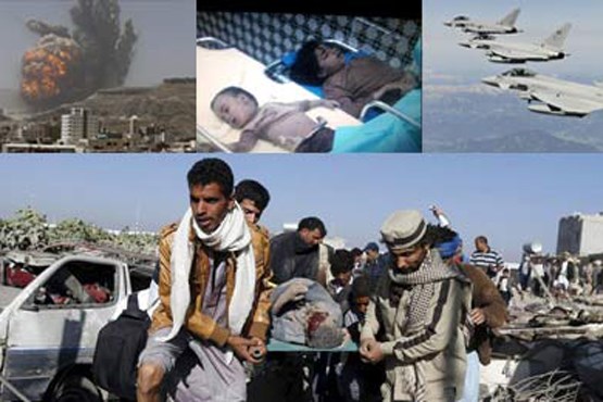 ۵۴ شهید و ۳۲۰ زخمی حاصل حملات سعودی به صنعا