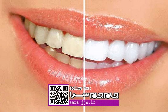 6 اشتباه رایجی که دندان‌هایتان را زرد می‌کنند