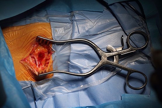 شگفت انگیزترین جراحی های پزشکی 2016