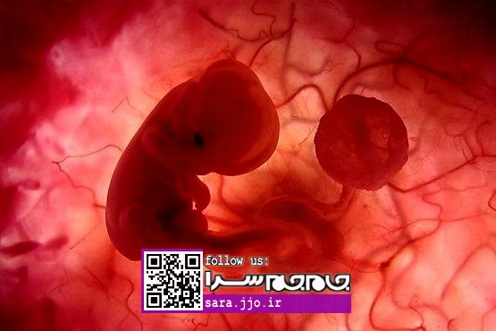 مغز جنین، نخستین قربانی امواج تلفن همراه