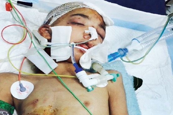کودک 9 ساله در بیمارستان جان باخت + عکس