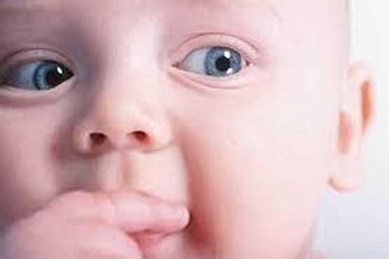 کامل نشدن عضلات چشم علت انحراف چشم در نوزادان