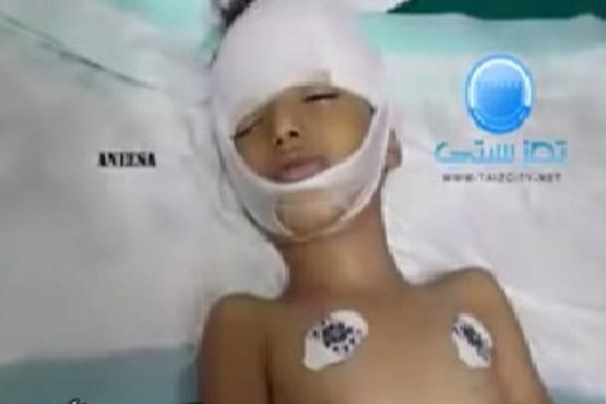 تاثر کابران شبکه های اجتماعی از فریاد بی صدای کودک یمنی+فیلم