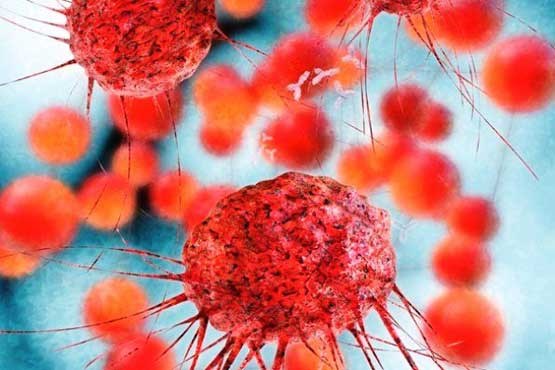 مبارزه با سرطان خون با تزریق دوز بالای ویتامین C