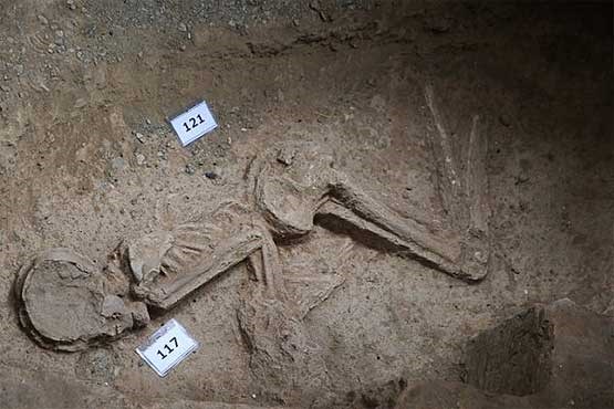 تصویر مرگ زن 7 هزار ساله تهران به دلیل عفونت