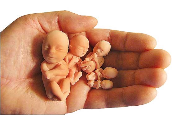 تبلیغات مجازی به سقط جنین رسید ! +تصاویر