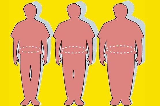 جراحی متابولیک، نه به بهانه چاقی