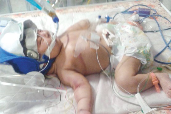 پدر معتاد نوزادش را ضربه مغزی کرد +عکس