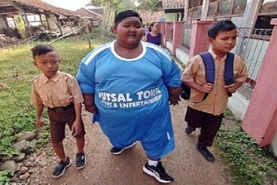 چاق ترین کودک 10ساله جهان+عکس