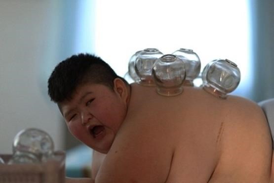 چاق‌ترین کودک جهان (عکس)