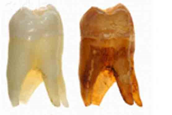 کشف دندان باستانی با سه ریشه +عکس