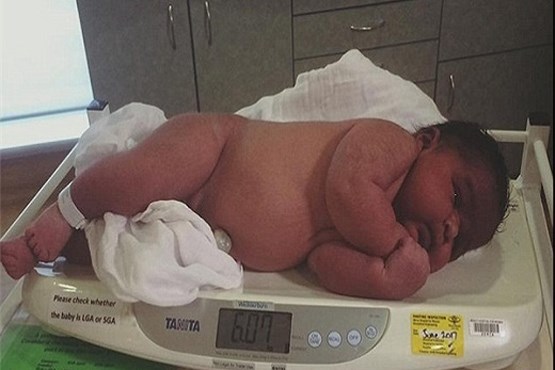 تولد نوزاد 6 کیلویی در استرالیا +عکس