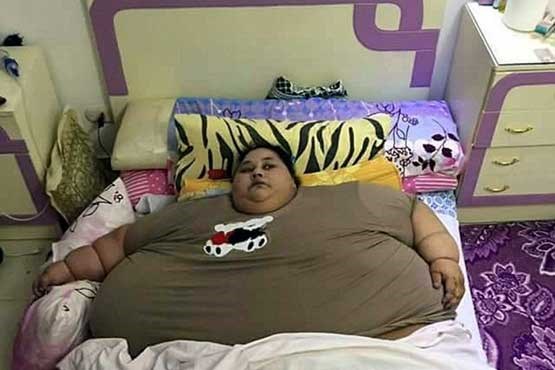 عمل جراحی چاق ترین زن جهان+عکس