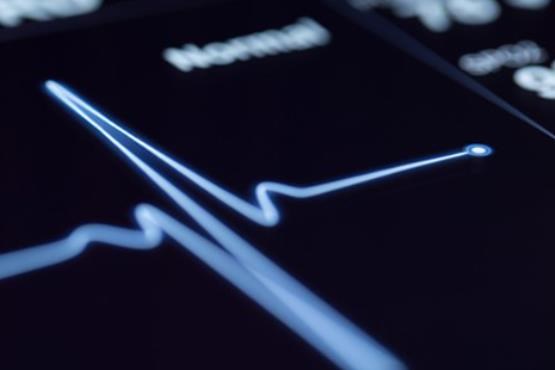 هوش مصنوعی اکنون می‌تواند حملات قلبی را با دقت‌ بیشتری از دکترها پیش بینی کند