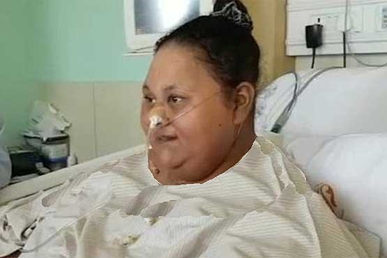 پزشکان معالج چاق‌ترین زن دنیا از ادامه درمان او انصراف دادند