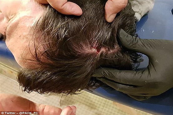 جنجال در فوتبال یونان/ حمله به یک مربی او را روانه بیمارستان کرد+تصاویر
