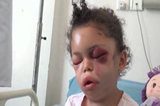 جنایت سعودی ها با دختر پنج ساله یمنی و خانواده‌اش + فیلم