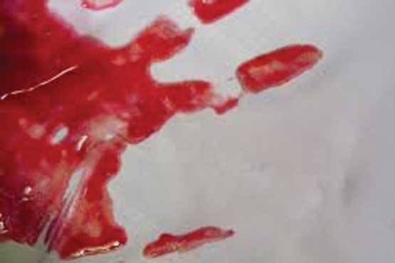 قتل پدر با ضربه‌های بطری آب +عکس