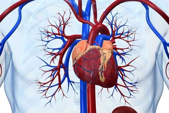 استفاده از وصله عضلانی برای ترمیم عضلات آسیب‌ دیده قلب
