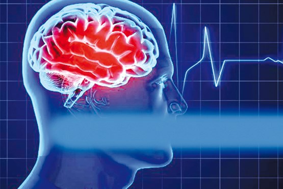 خطر ابتلا به سکته مغزی با افزایش آهن خون