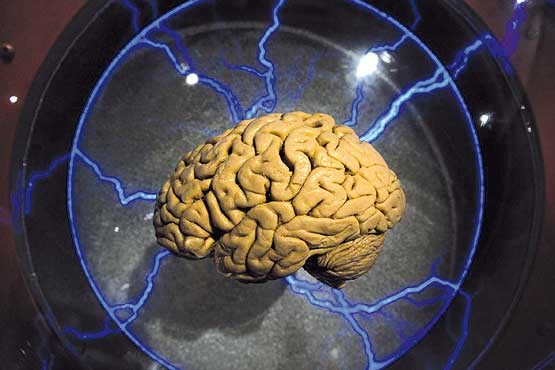 غذاهای مضر برای مغز انسان+اینفوگرافی