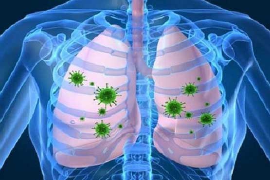 راه‌های پیشگیری از عفونت های تنفسی در زمستان