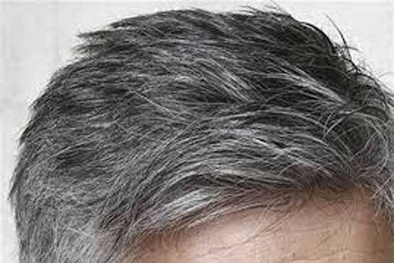 کشف علت سفید شدن موی سر